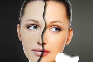 连城祛斑视频热门话题,揭秘热门话题背后的祛斑奇迹