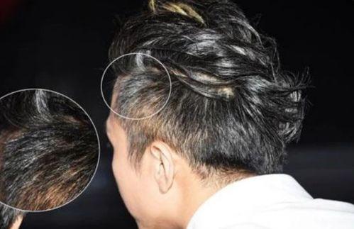 白头发的热门话题男生,男生白头发的时尚潮流与生活态度